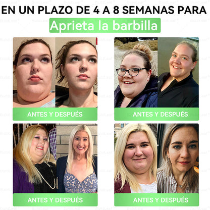 𝐓𝐢𝐞𝐧𝐝𝐚 𝐎𝐟𝐢𝐜𝐢𝐚𝐥 | 𝗕𝘂𝗶𝗹𝗱𝗹𝗲𝗮𝗳® 🍒 𝐆𝐋𝐏-𝟏 𝐒𝐨𝐥𝐮𝐜𝐢ó𝐧 𝐎𝐫𝐚𝐥 𝟐𝟎-𝐞𝐧-𝟏 (𝟏 𝐝𝐨𝐬𝐢𝐬 𝐚𝐥 𝐝í𝐚, 𝐜𝐚𝐦𝐛𝐢𝐨𝐬 𝐯𝐢𝐬𝐢𝐛𝐥𝐞𝐬 𝐞𝐧 𝟕 𝐝í𝐚𝐬) ✅ 𝐏𝐮𝐞𝐝𝐞 𝐚𝐲𝐮𝐝𝐚𝐫 𝐜𝐨𝐧 𝐨𝐛𝐞𝐬𝐢𝐝𝐚𝐝, 𝐬𝐚𝐥𝐮𝐝 𝐜𝐚𝐫𝐝𝐢𝐨𝐯𝐚𝐬𝐜𝐮𝐥𝐚𝐫, 𝐜𝐨𝐧𝐭𝐫𝐨𝐥 𝐝𝐞 𝐥𝐚 𝐝𝐢𝐚𝐛𝐞𝐭𝐞𝐬, 𝐚𝐩𝐧𝐞𝐚 𝐝𝐞𝐥 𝐬𝐮𝐞ñ𝐨, 𝐬𝐚𝐥𝐮𝐝 𝐚𝐫𝐭𝐢𝐜𝐮𝐥𝐚𝐫 𝐲 𝐦á𝐬