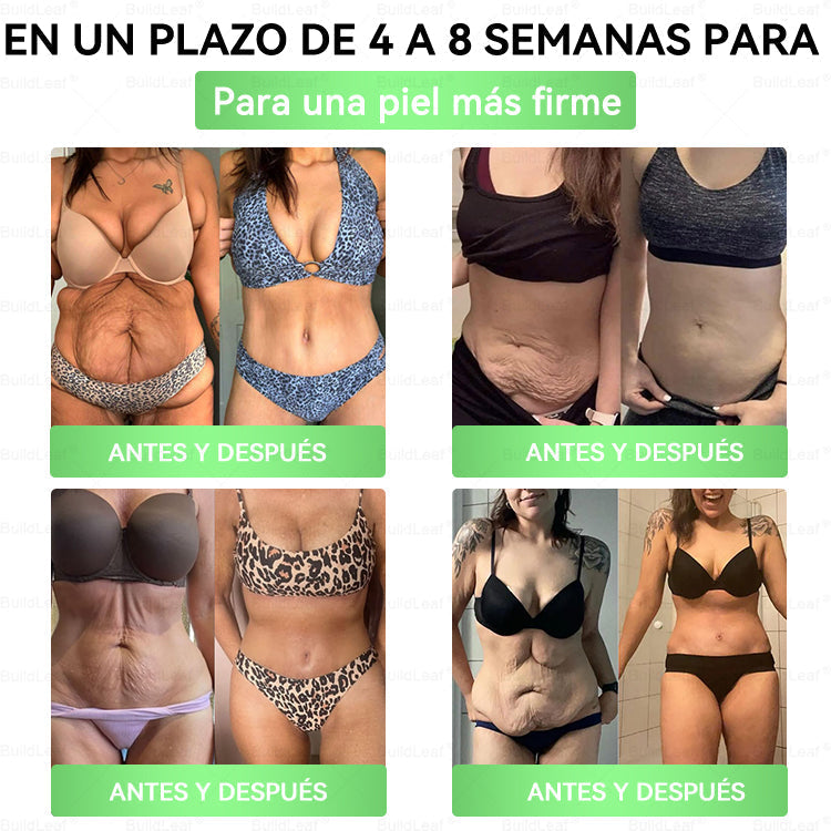 𝐓𝐢𝐞𝐧𝐝𝐚 𝐎𝐟𝐢𝐜𝐢𝐚𝐥 | 𝗕𝘂𝗶𝗹𝗱𝗹𝗲𝗮𝗳® 🍒 𝐆𝐋𝐏-𝟏 𝐒𝐨𝐥𝐮𝐜𝐢ó𝐧 𝐎𝐫𝐚𝐥 𝟐𝟎-𝐞𝐧-𝟏 (𝟏 𝐝𝐨𝐬𝐢𝐬 𝐚𝐥 𝐝í𝐚, 𝐜𝐚𝐦𝐛𝐢𝐨𝐬 𝐯𝐢𝐬𝐢𝐛𝐥𝐞𝐬 𝐞𝐧 𝟕 𝐝í𝐚𝐬) ✅ 𝐏𝐮𝐞𝐝𝐞 𝐚𝐲𝐮𝐝𝐚𝐫 𝐜𝐨𝐧 𝐨𝐛𝐞𝐬𝐢𝐝𝐚𝐝, 𝐬𝐚𝐥𝐮𝐝 𝐜𝐚𝐫𝐝𝐢𝐨𝐯𝐚𝐬𝐜𝐮𝐥𝐚𝐫, 𝐜𝐨𝐧𝐭𝐫𝐨𝐥 𝐝𝐞 𝐥𝐚 𝐝𝐢𝐚𝐛𝐞𝐭𝐞𝐬, 𝐚𝐩𝐧𝐞𝐚 𝐝𝐞𝐥 𝐬𝐮𝐞ñ𝐨, 𝐬𝐚𝐥𝐮𝐝 𝐚𝐫𝐭𝐢𝐜𝐮𝐥𝐚𝐫 𝐲 𝐦á𝐬